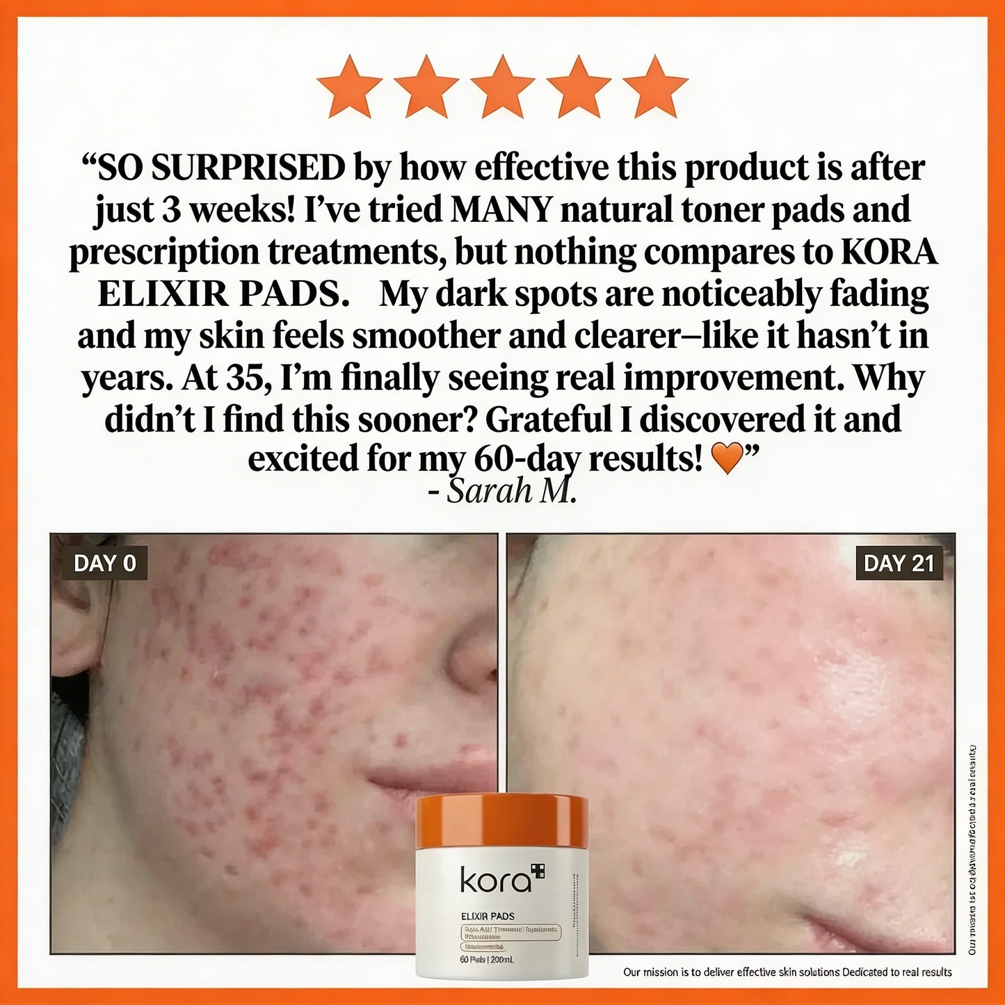 KORA Elixir Pads - Dark Spot Treatment