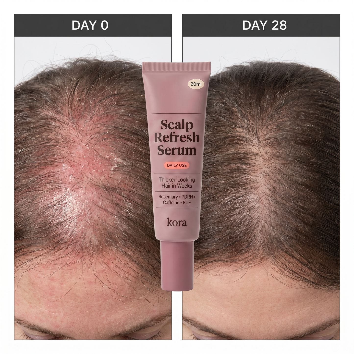 Kora Scalp Refresh Serum