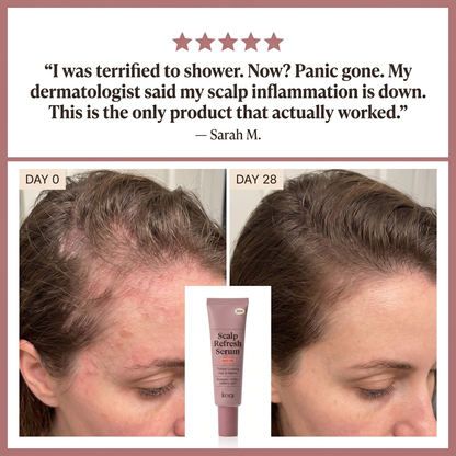 Kora Scalp Refresh Serum